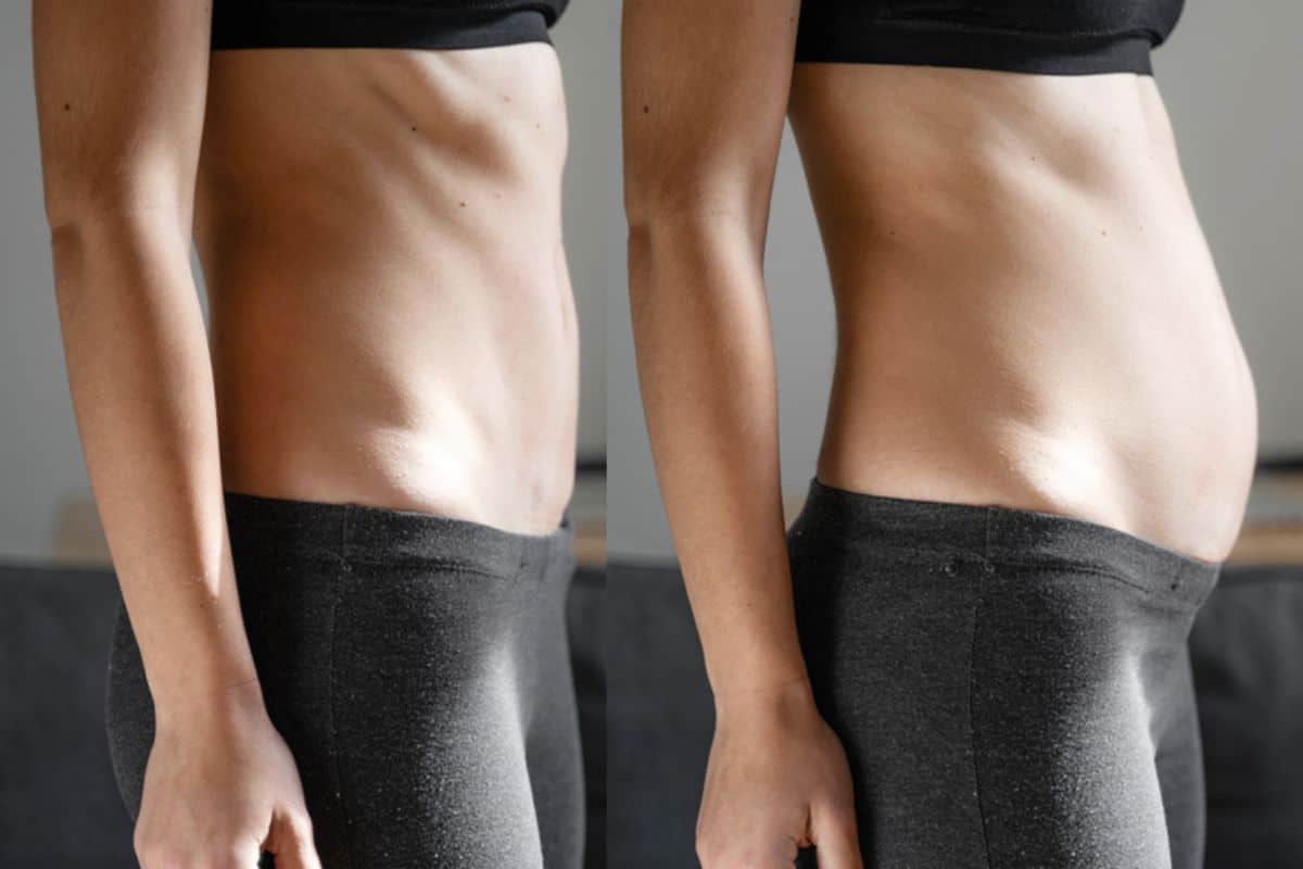 How long does diastasis recti take to improve West Kilburn?