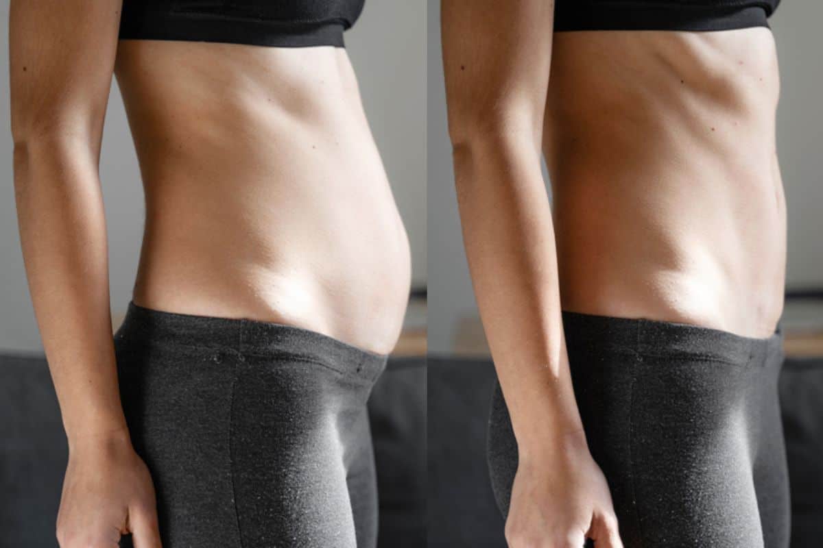 Post-Pregnancy: What Happens to Your Abdominal Muscles After Birth West Kilburn
