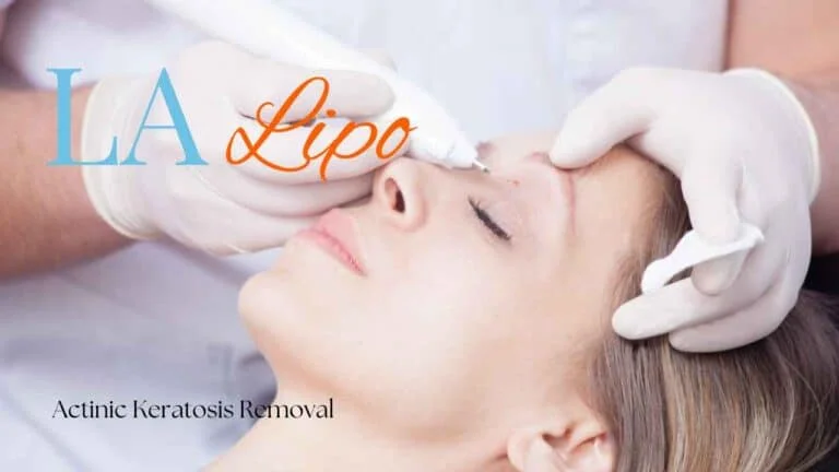 Woman receiving Actinic Keratosis Removal Treatment West Kilburn