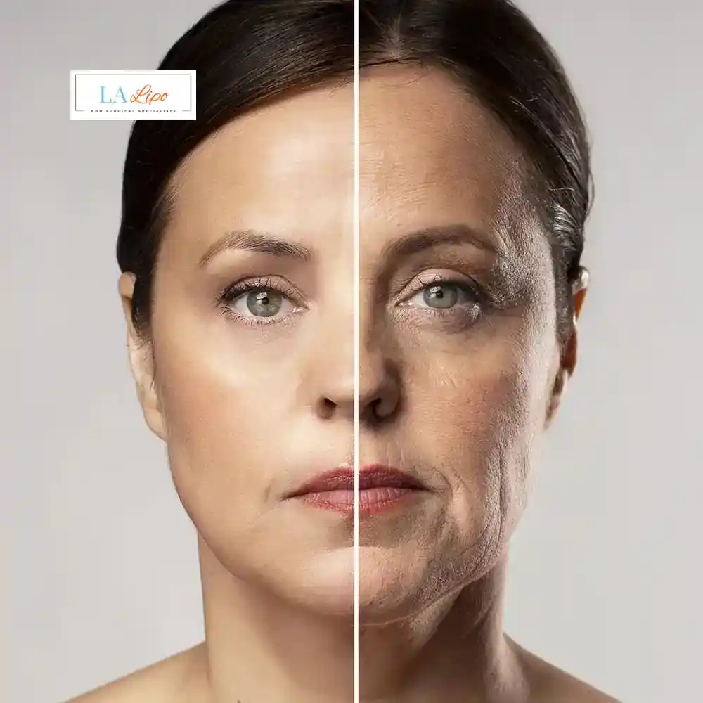 How Can You Tell If Non-Surgical Skin Tightening Is Right for You West Kilburn?