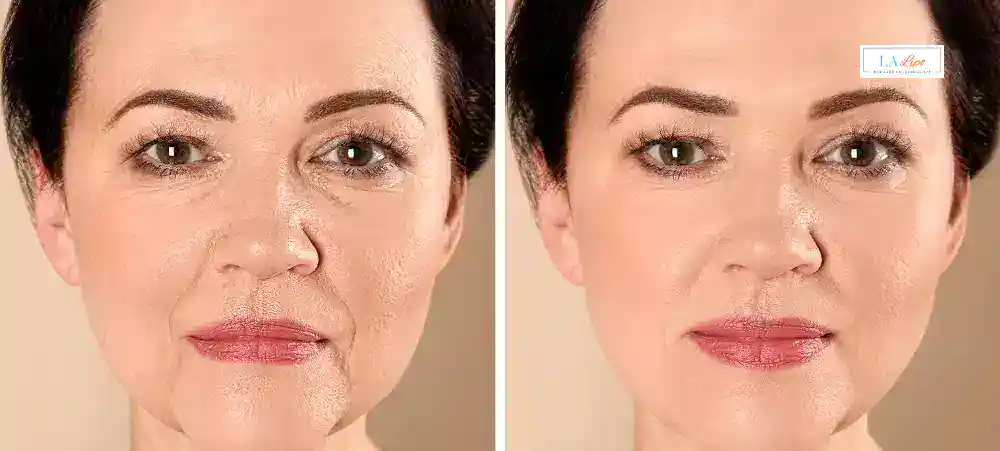 Why Aren’t My Skincare Products Making My Sagging Skin Look Firmer West Kilburn?