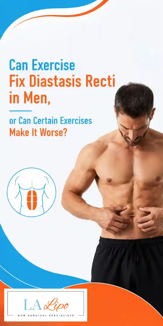 Can Exercise Fix Diastasis Recti in Men, or Can Certain Exercises Make It Worse West Kilburn?