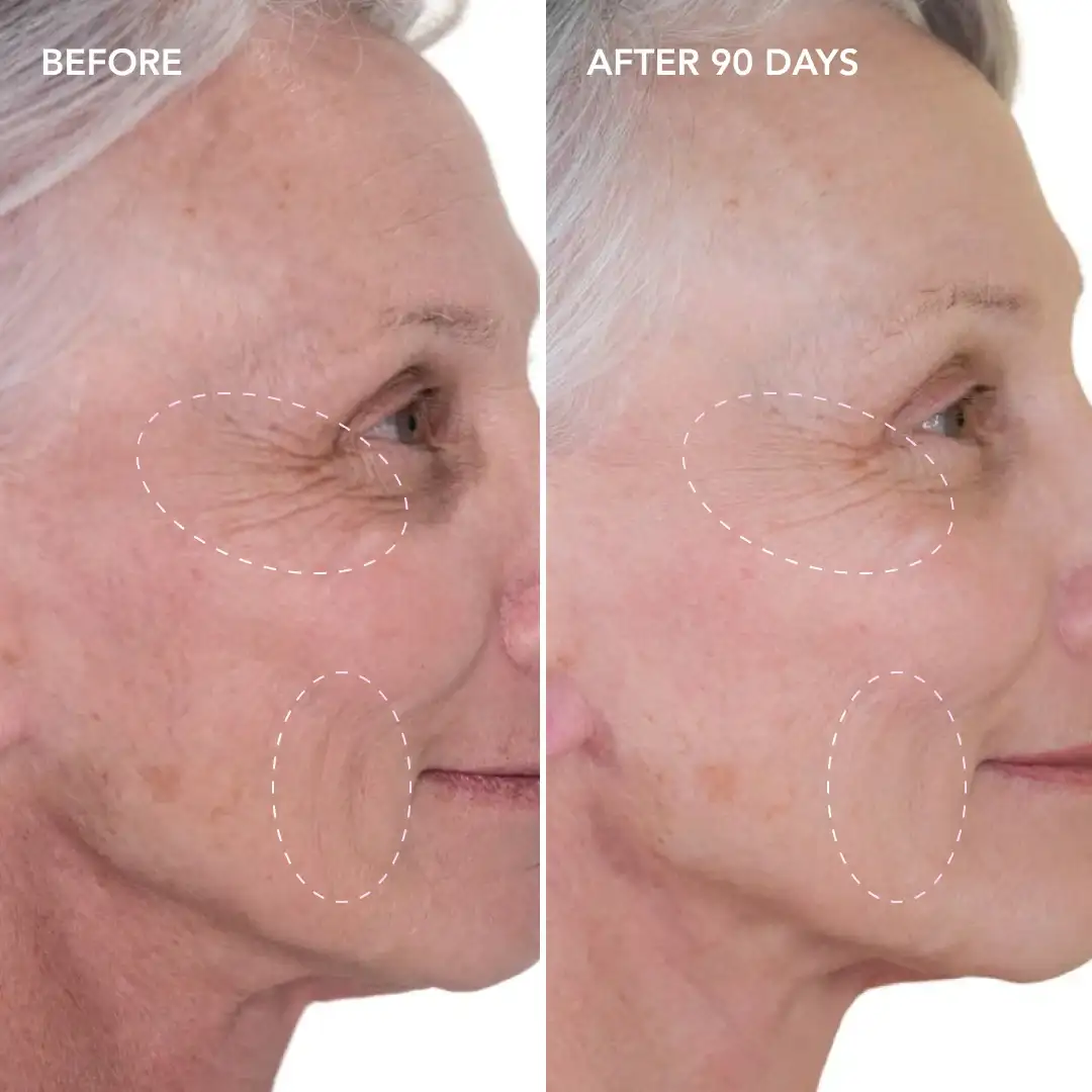 When will you see results West Kilburn